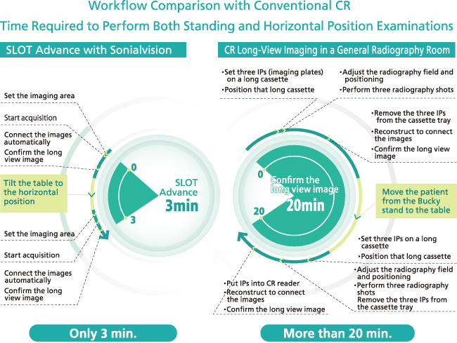 Workflow Comparison with Conventional CR Time Required to Perform Both Standing and Horizontal Position Examinations